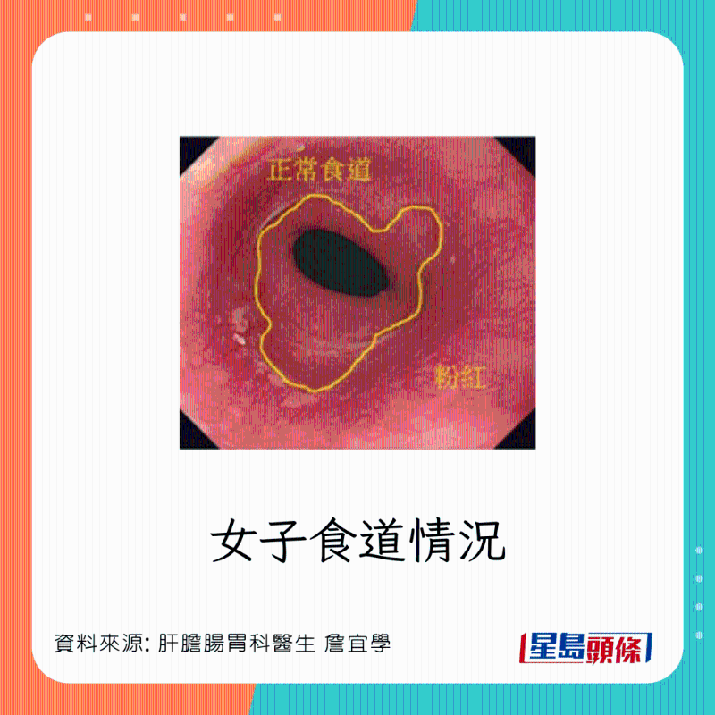 女患者情况正常