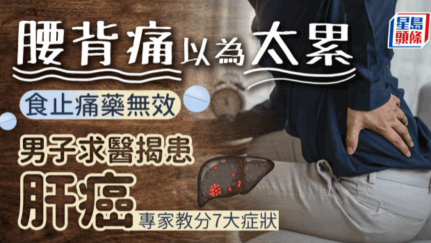 腰痠背痛食止痛药无效，男子求医揭患肝癌生巨瘤