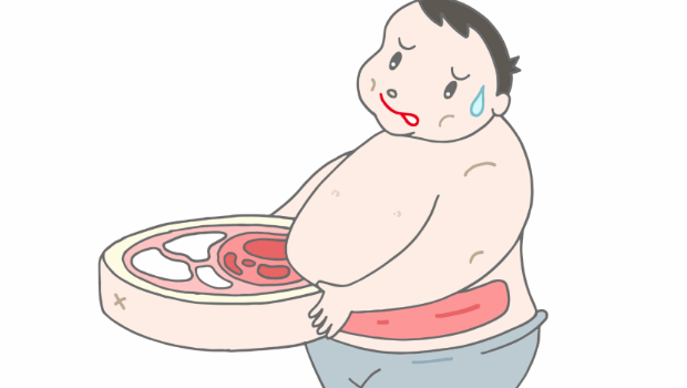 肥胖 肥胖
