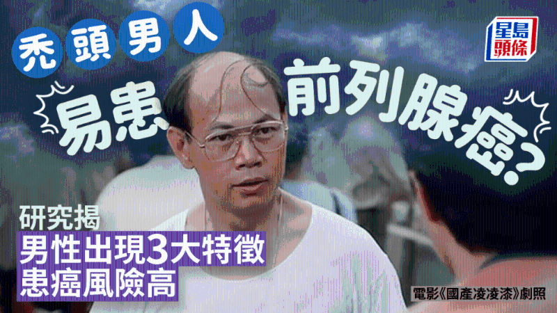 秃头男患前列腺癌风险高？研究揭男性出现3大特征恐患癌