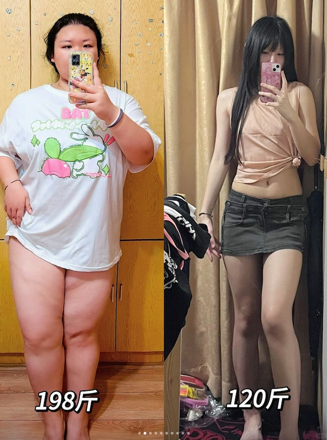 后来成功半年内减掉70多斤(约43kg),不但减走大肚腩。 (图片来源:喵辣@小红书) 后来成功半年内减掉70多斤(约43kg),不但减走大肚腩。 (图片来源:喵辣@小红书)