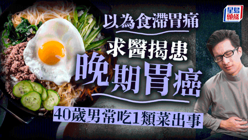 胃癌 胃癌
