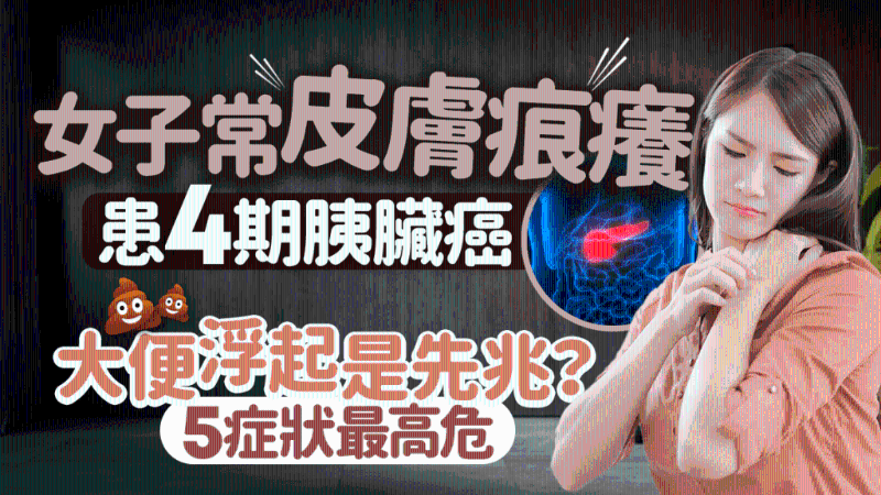 胰脏 胰脏