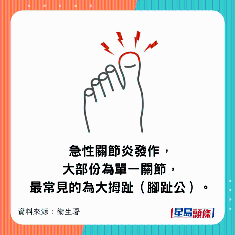 急性关节炎发作,大部份为单一关节,最常见的为大拇趾(脚趾公) 急性关节炎发作,大部份为单一关节,最常见的为大拇趾(脚趾公)