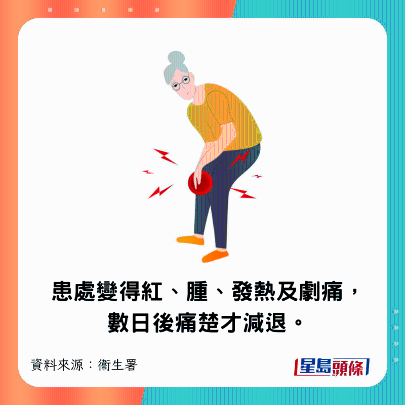 患处突然变得红、肿、发热及剧痛,数日后痛楚才减退。 患处突然变得红、肿、发热及剧痛,数日后痛楚才减退。