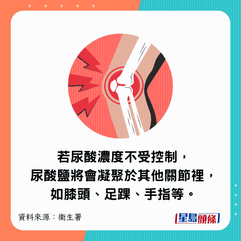若血液内的尿酸浓度不受控制,尿酸盐将会凝聚于其他关节里,如膝头、足踝、手指等。 若血液内的尿酸浓度不受控制,尿酸盐将会凝聚于其他关节里,如膝头、足踝、手指等。