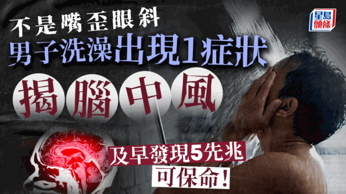 中风先兆 中风先兆