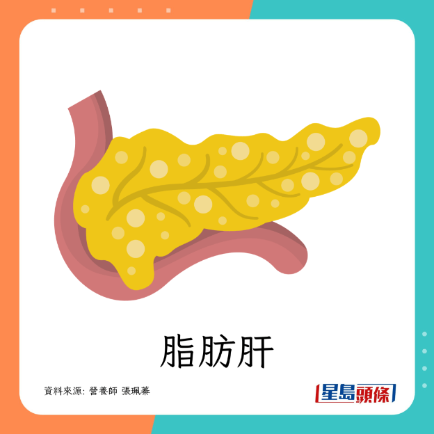 脂肪肝 脂肪肝