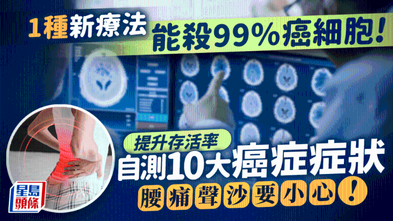 癌症治疗 癌症治疗