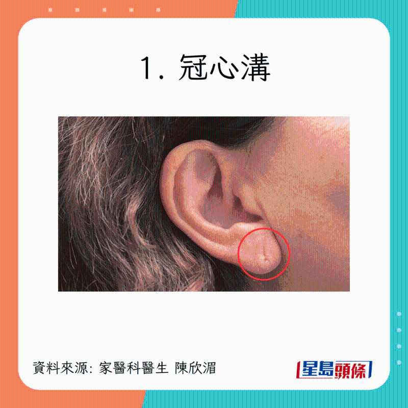 1 1