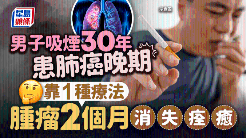 肺癌治疗 肺癌治疗