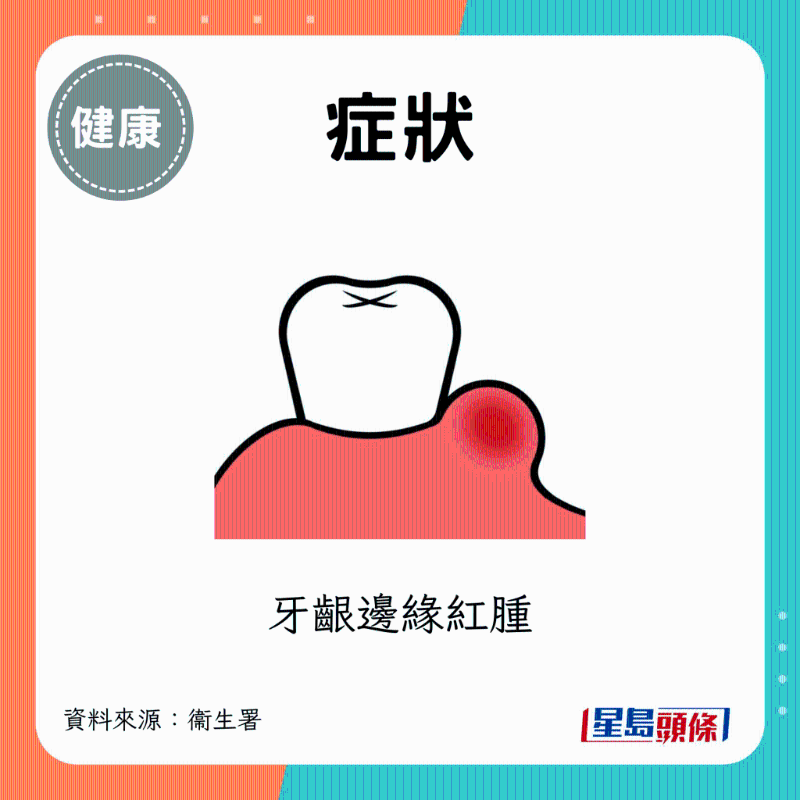 牙龈边缘红肿 牙龈边缘红肿
