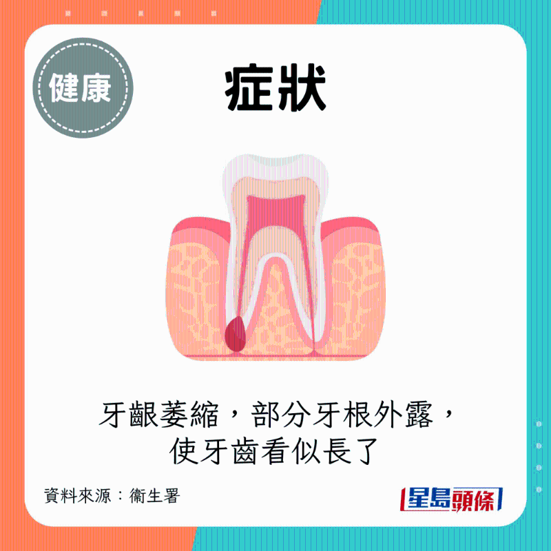 牙龈萎缩 牙龈萎缩