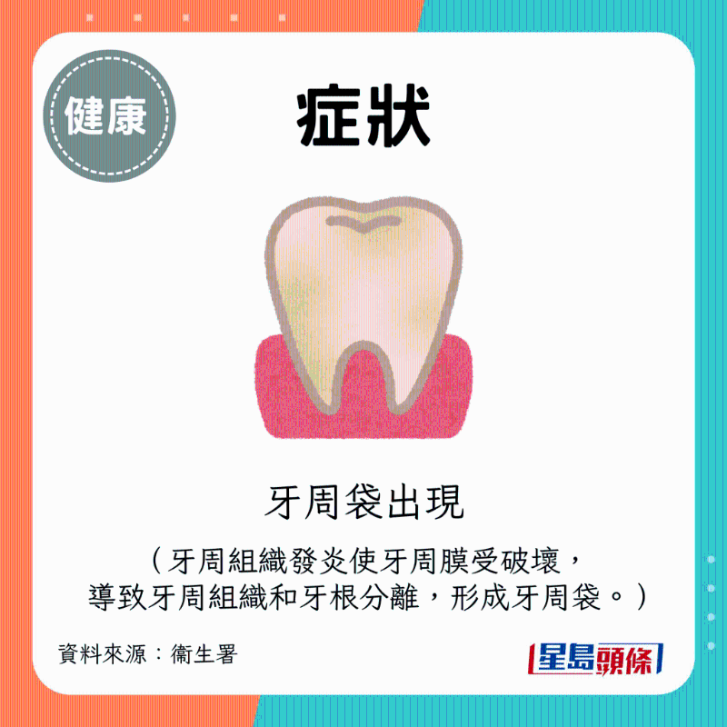牙周袋出现 牙周袋出现