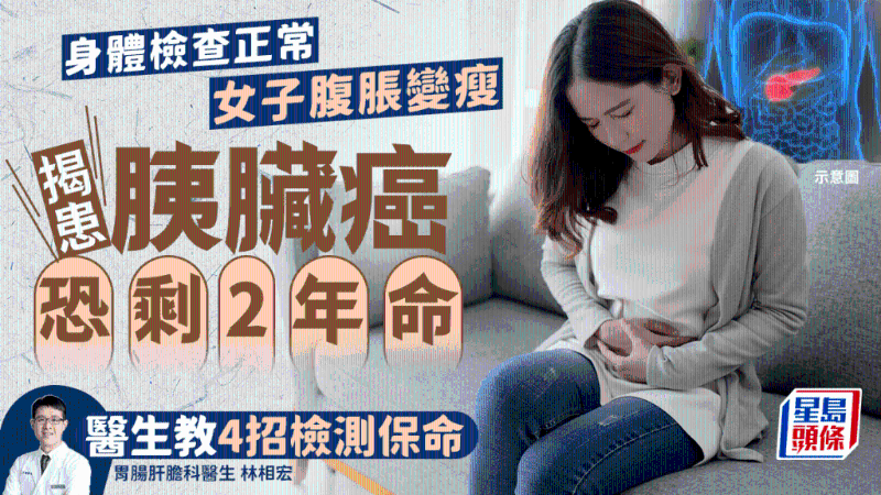 胰脏癌