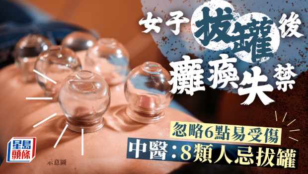 女子拔罐后瘫痪失禁 女子拔罐后瘫痪失禁