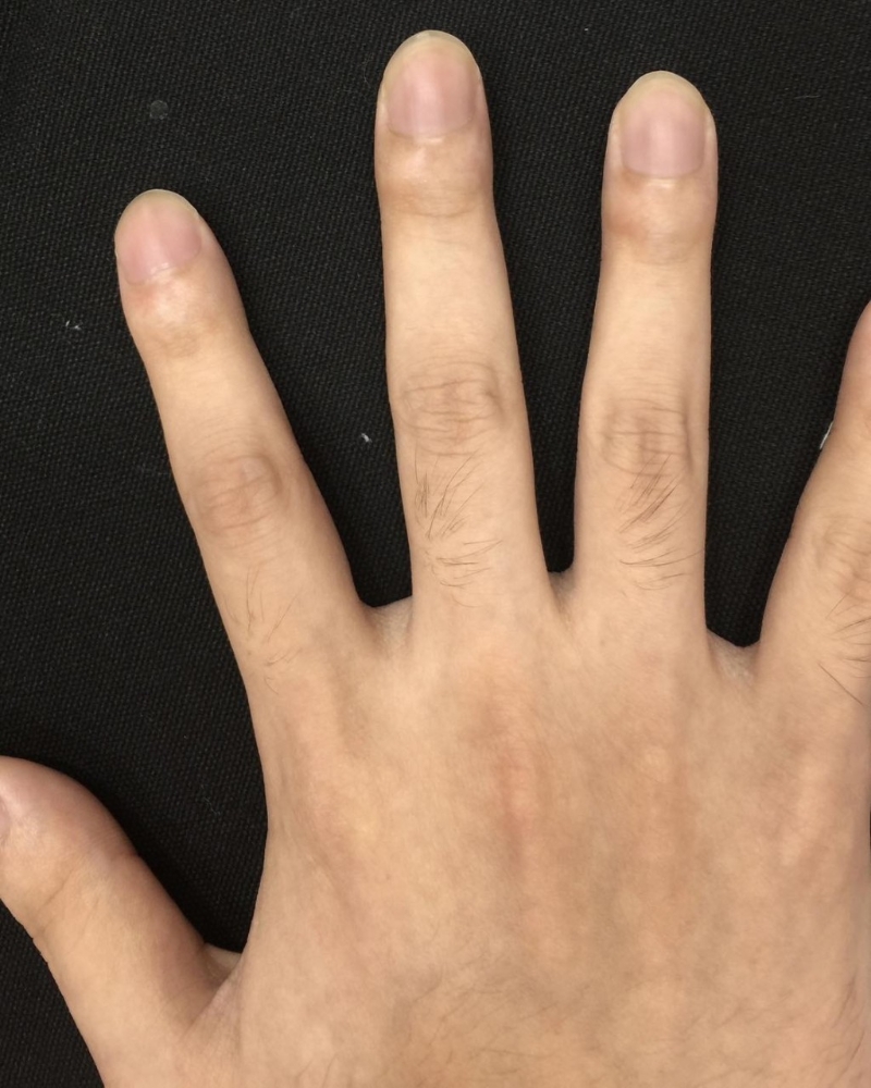 1 1