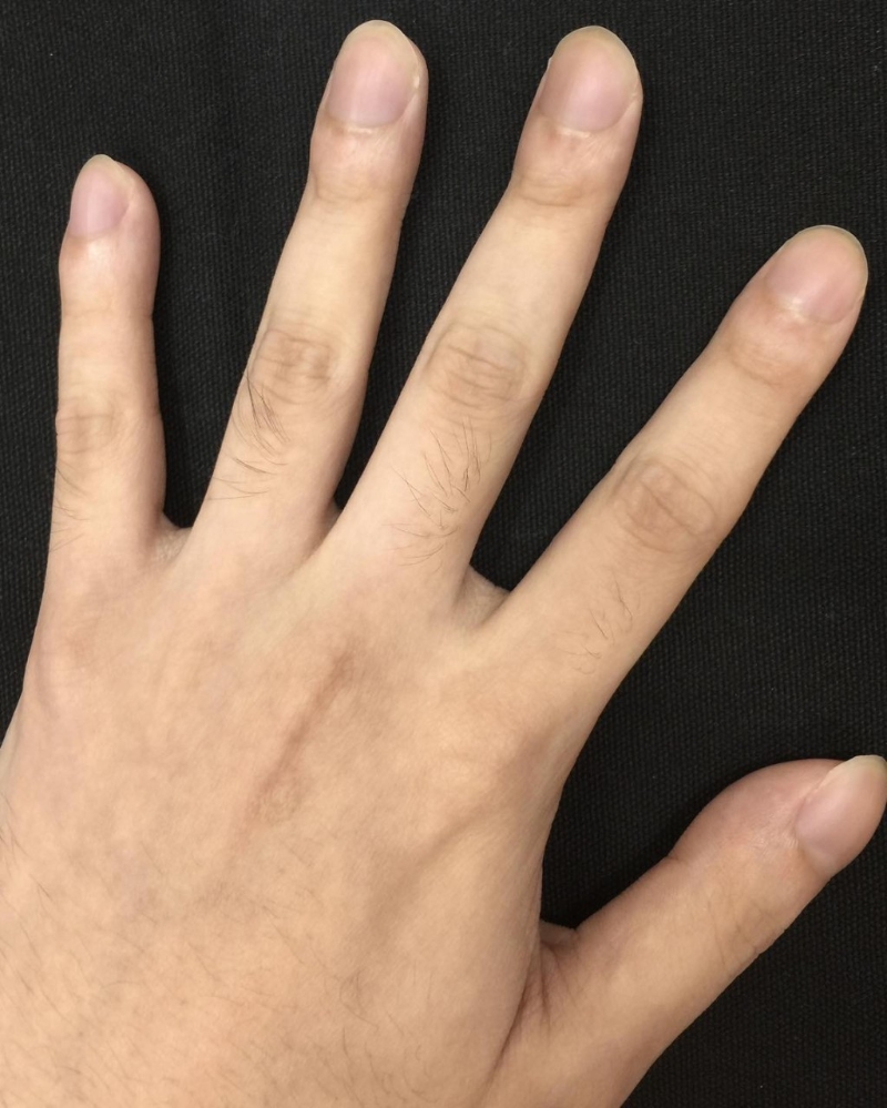 2 2