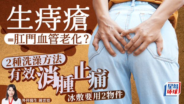 生痔疮 生痔疮