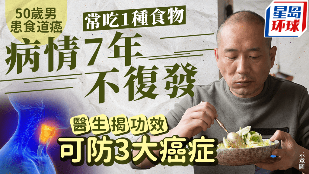 50岁男患食道癌 50岁男患食道癌