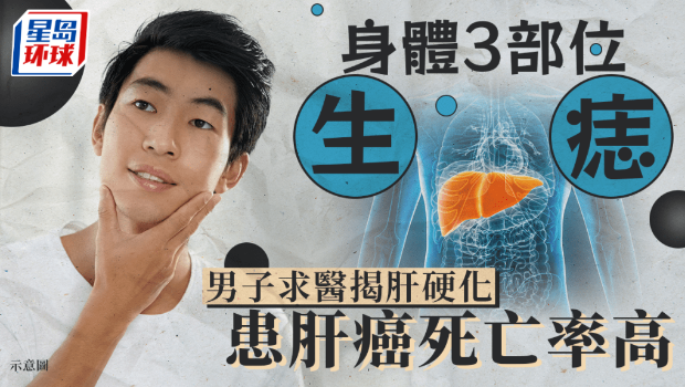 痣 痣