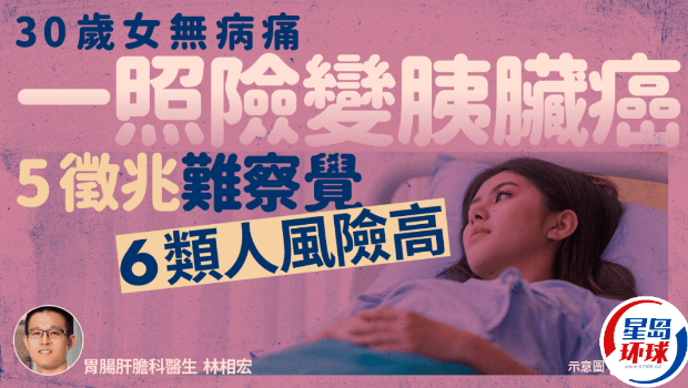胰脏癌 胰脏癌