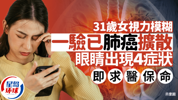 视力模糊 视力模糊