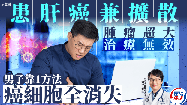 肝癌 肝癌