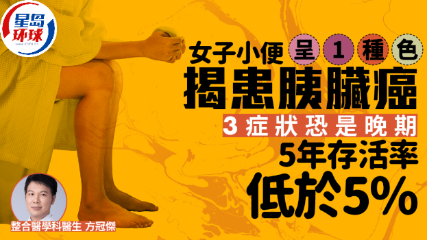 胰脏癌 胰脏癌
