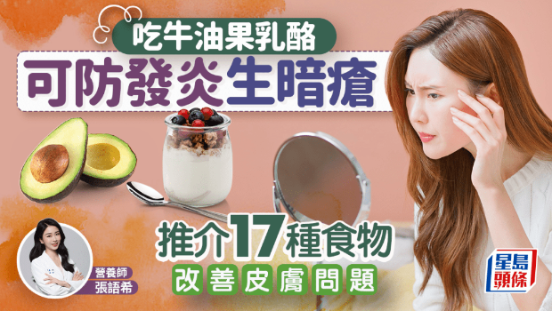吃牛油果奶酪可防发炎生暗疮? 吃牛油果奶酪可防发炎生暗疮?