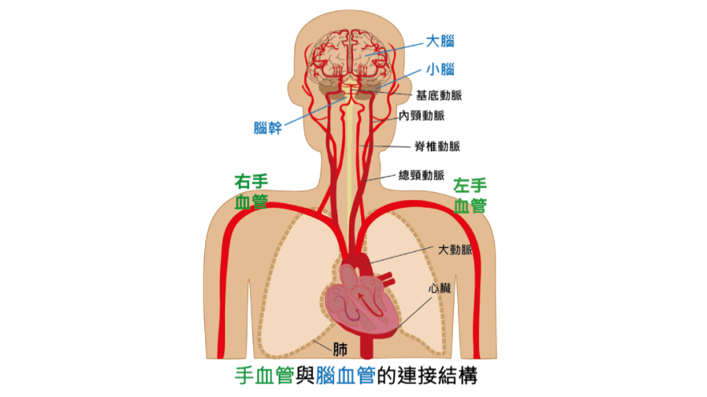 手血管与脑血管之间的关系 手血管与脑血管之间的关系