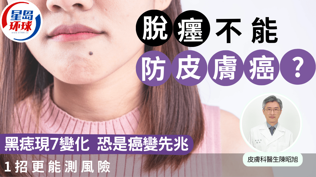 黑痣 黑痣