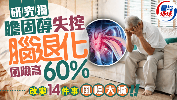 防脑退化 防脑退化
