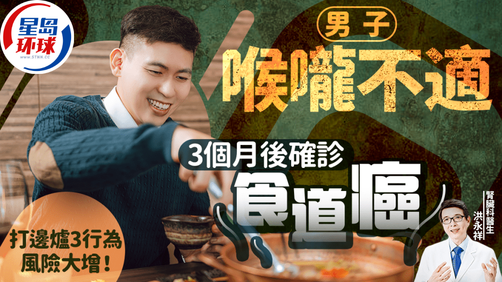 食道癌成因 食道癌成因
