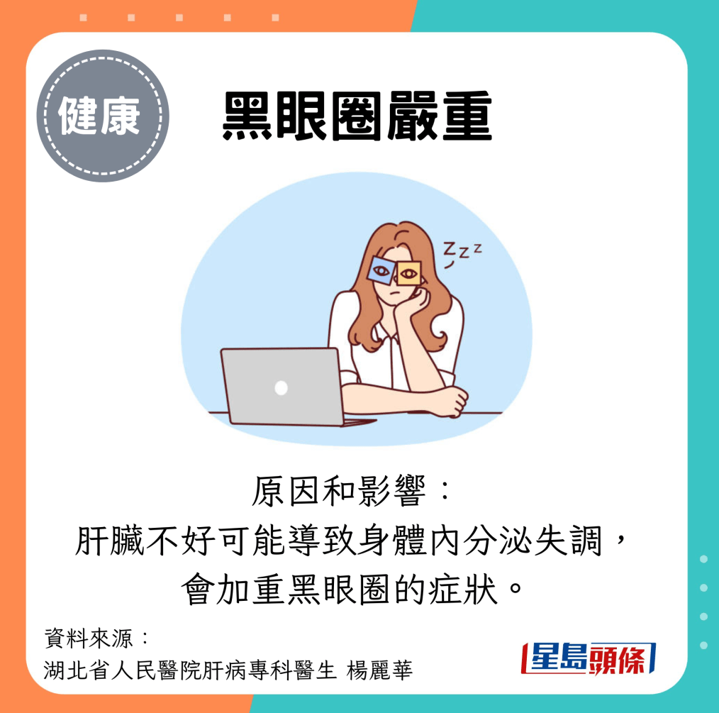 黑眼圈严重 黑眼圈严重
