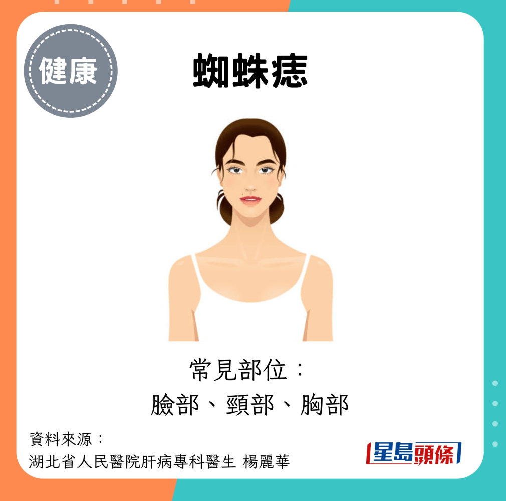 蜘蛛痣 蜘蛛痣