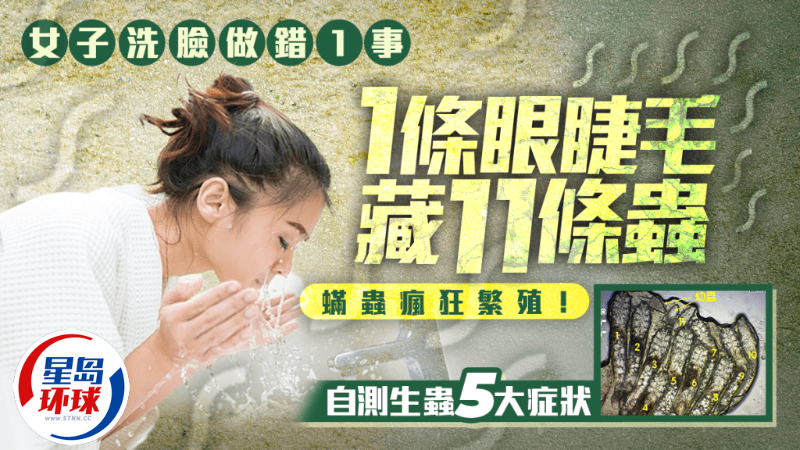 自测生虫5大症状 自测生虫5大症状