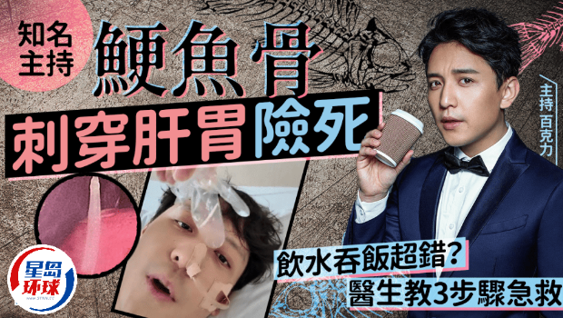 鱼骨 鱼骨