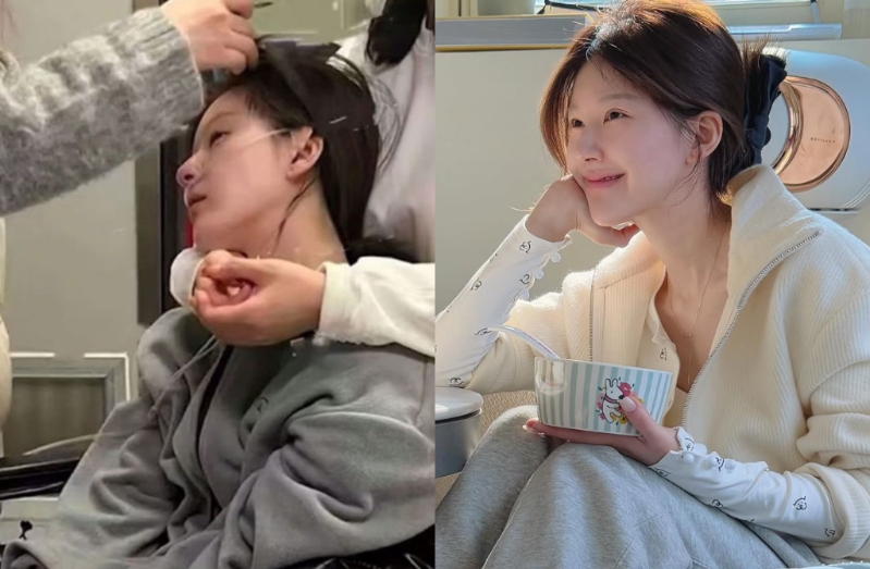 对比之前病倒、插管的样貌,赵露思气色好转许多。(图/赵露思IG) 对比之前病倒、插管的样貌,赵露思气色好转许多。(图/赵露思IG)