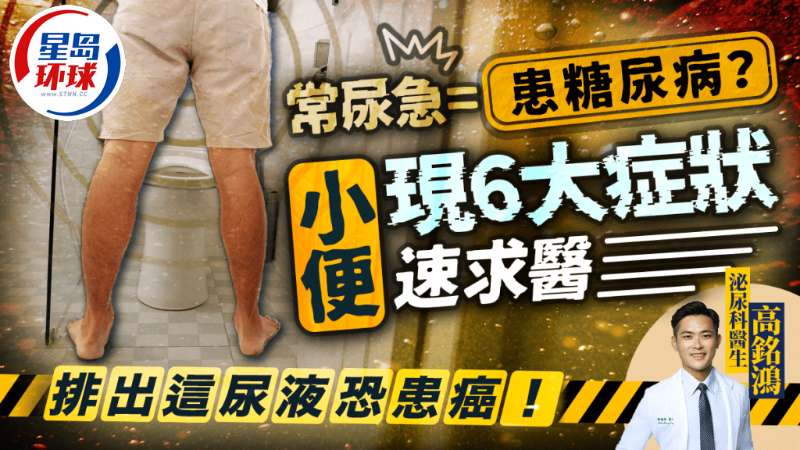 糖尿病、小便