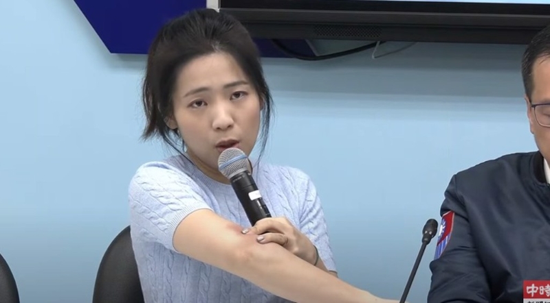 国民党立委徐巧芯秀伤痕照。（取自直播）