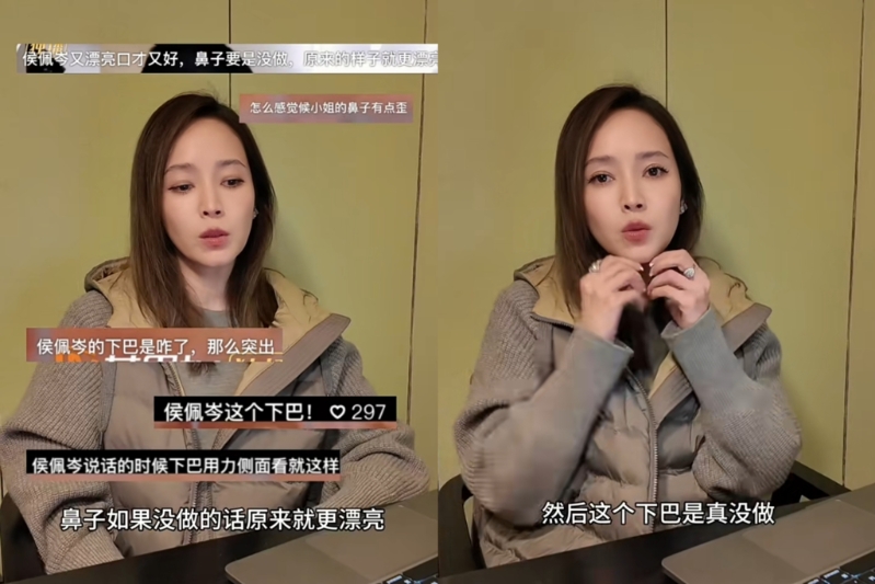 侯佩岑回应没整形。(图/翻摄自侯佩岑 小红书) 侯佩岑回应没整形。(图/翻摄自侯佩岑 小红书)