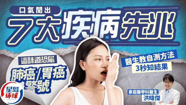 口臭 口臭