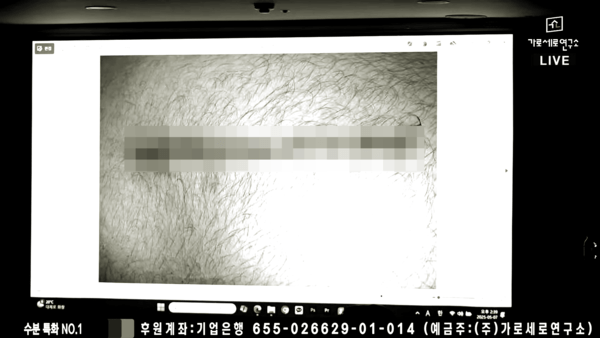 举报人颈部被刀刺了9次
