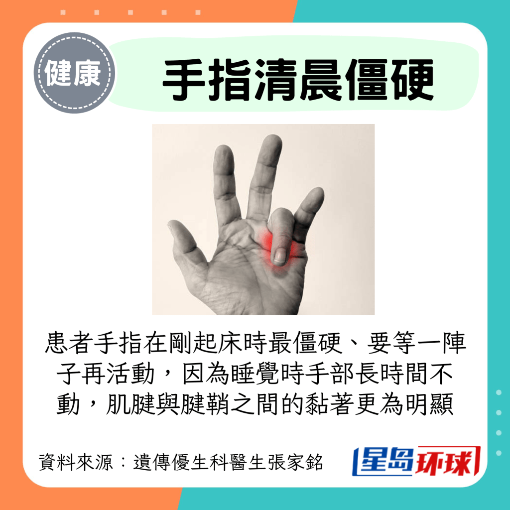 患者手指在刚起床时最僵硬、要等一阵子再活动，因为睡觉时手部长时间不动，肌腱与腱鞘之间的黏着更为明显