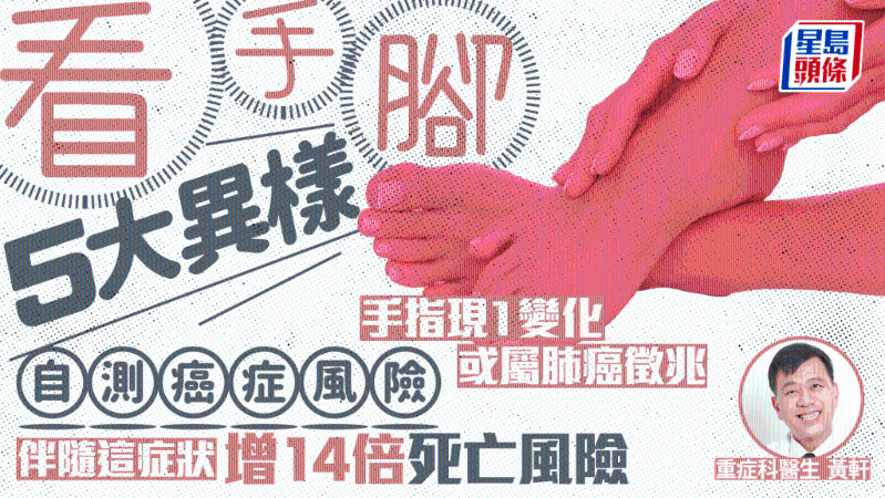 示意图