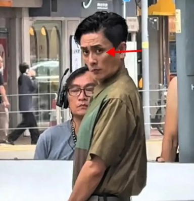 黄宗泽去年于街头被捕获，被指激瘦变成皮包骨。