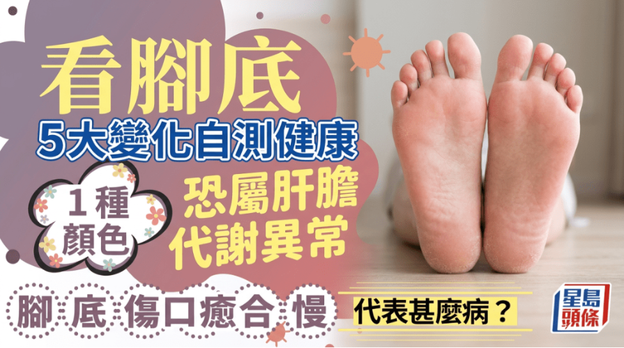 脚底伤口愈合慢代表什么？1种颜色恐属肝胆代谢异常，营养师教看脚底5大变化自测健康